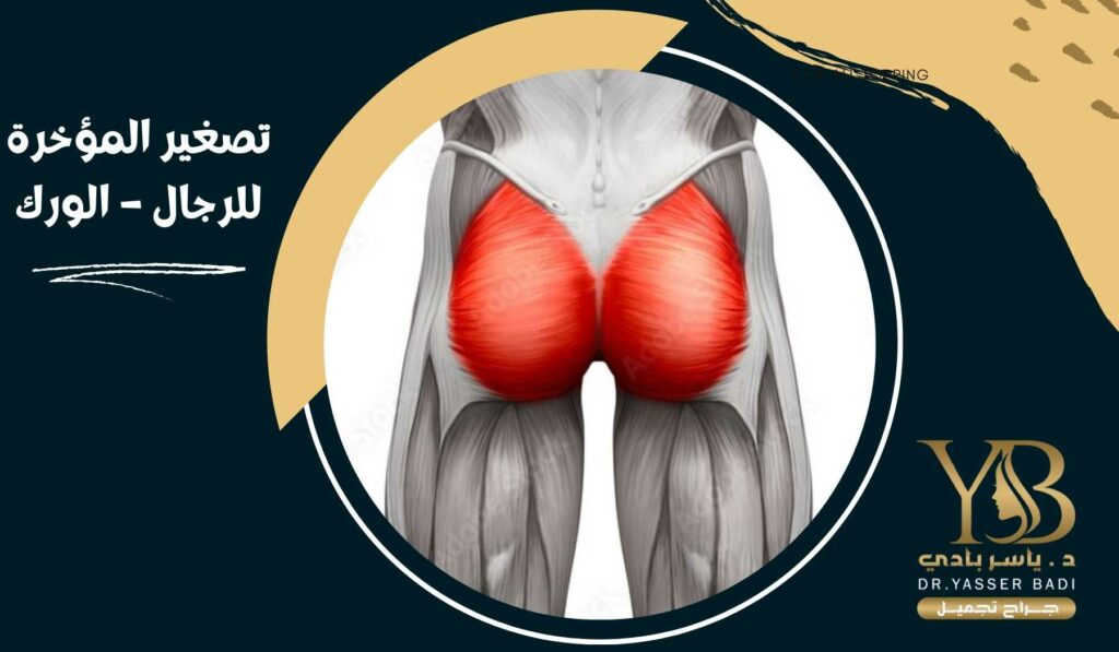 تصغير المؤخرة للرجال – الورك