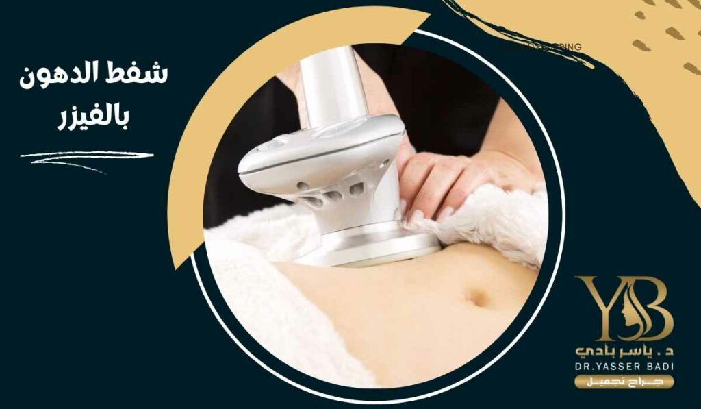 شفط الدهون بالفيزر