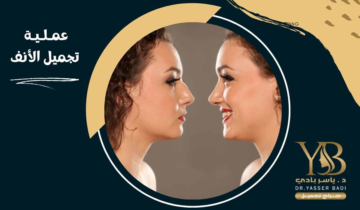 عملية تجميل الأنف