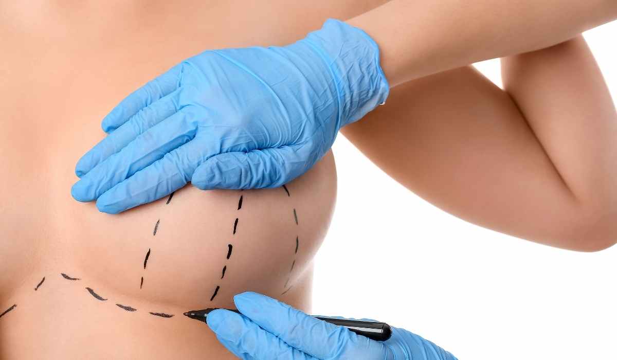 عملية تجميل الثدي