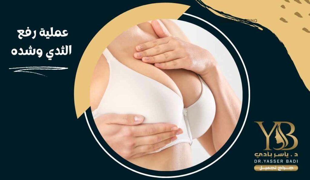 عملية رفع الثدي