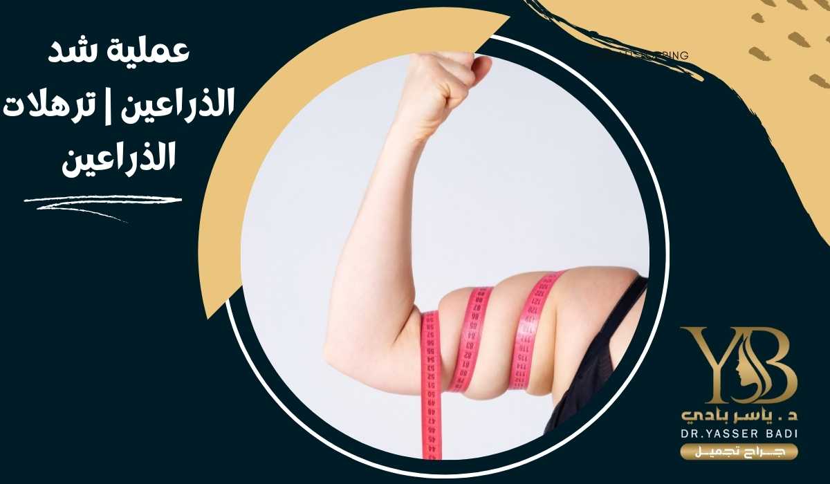 عملية شد الذراعين | ترهلات الذراعين