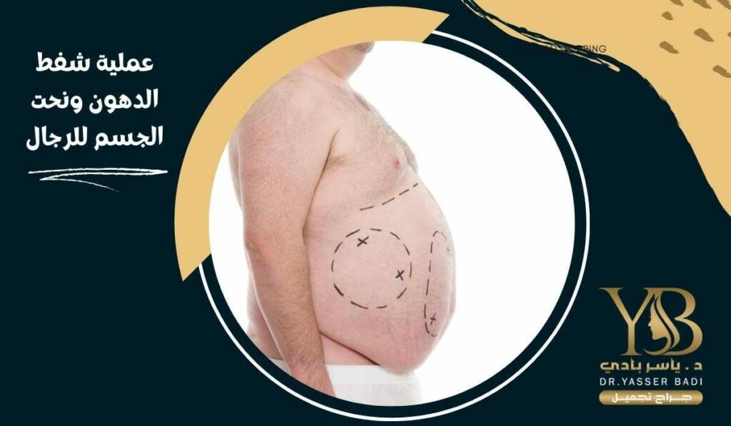 عملية شفط الدهون ونحت الجسم للرجال