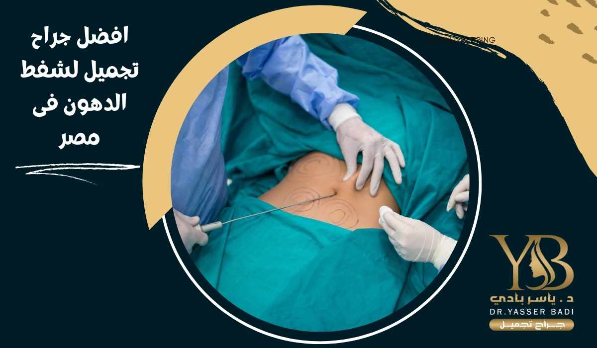 أفضل جراح تجميل لشفط الدهون في مصر