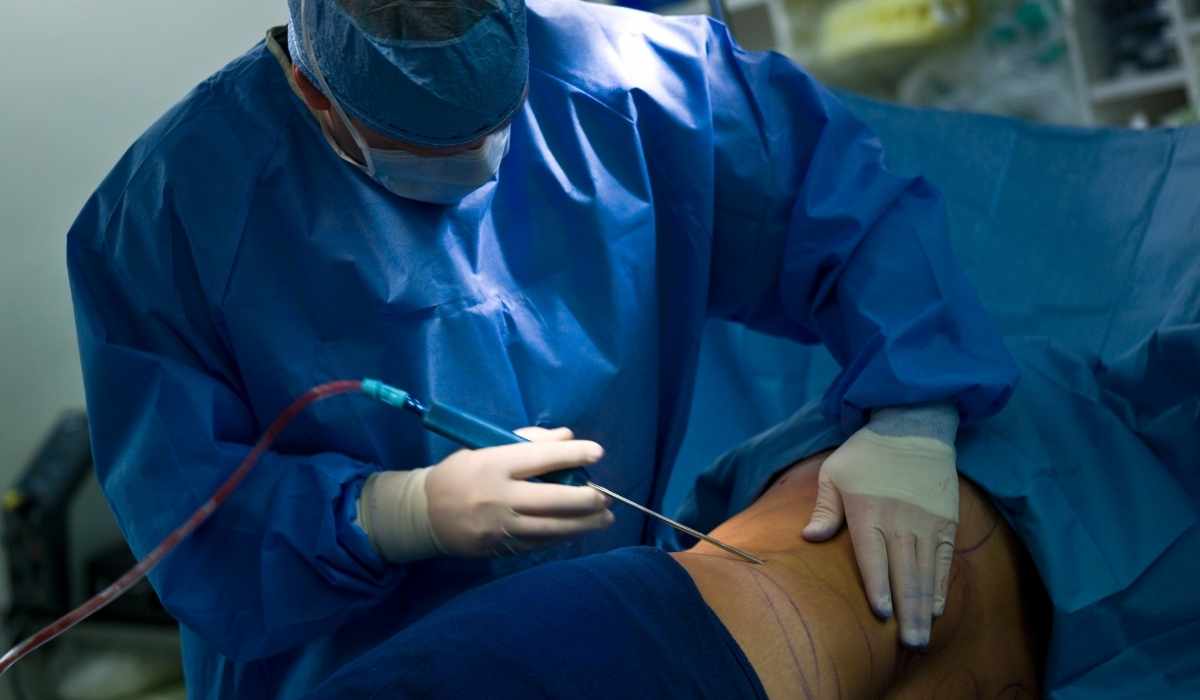 أفضل جراح تجميل لشفط الدهون في مصر