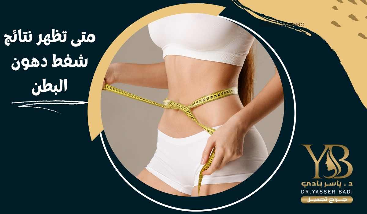 شفط دهون البطن | متى تظهر النتائج؟