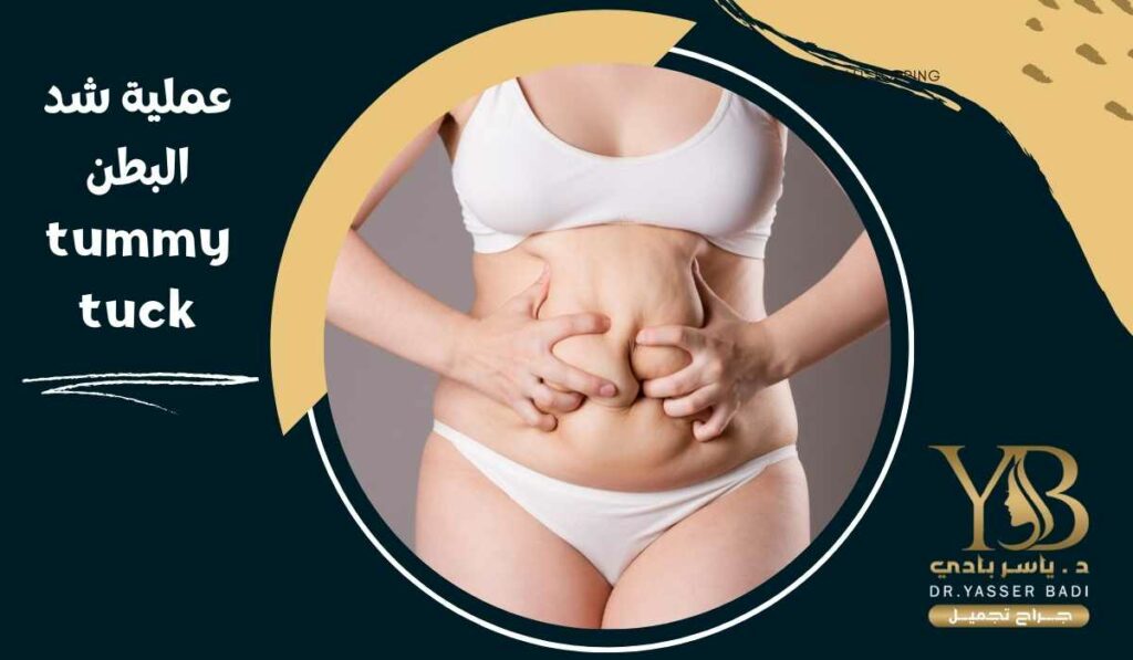 عملية شد البطن tummy tuck