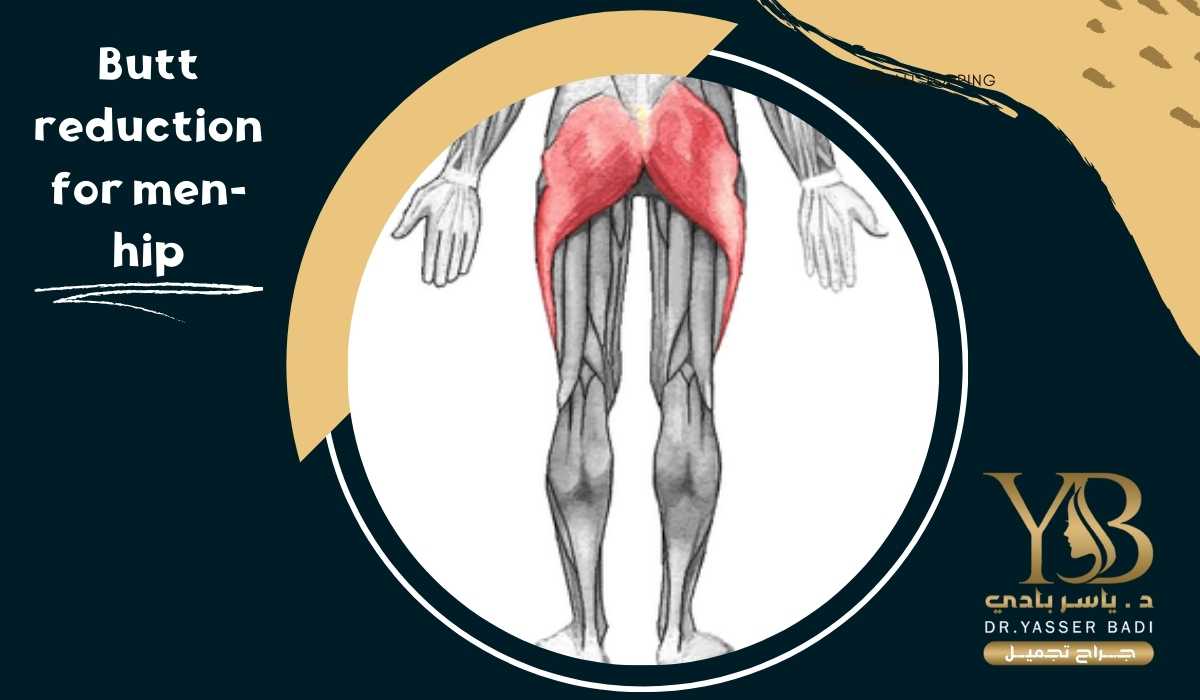 Butt reduction for men-hip