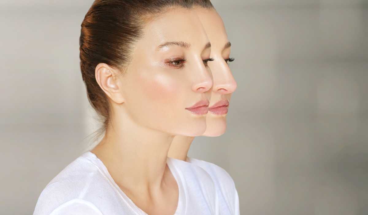 Rhinoplasty
