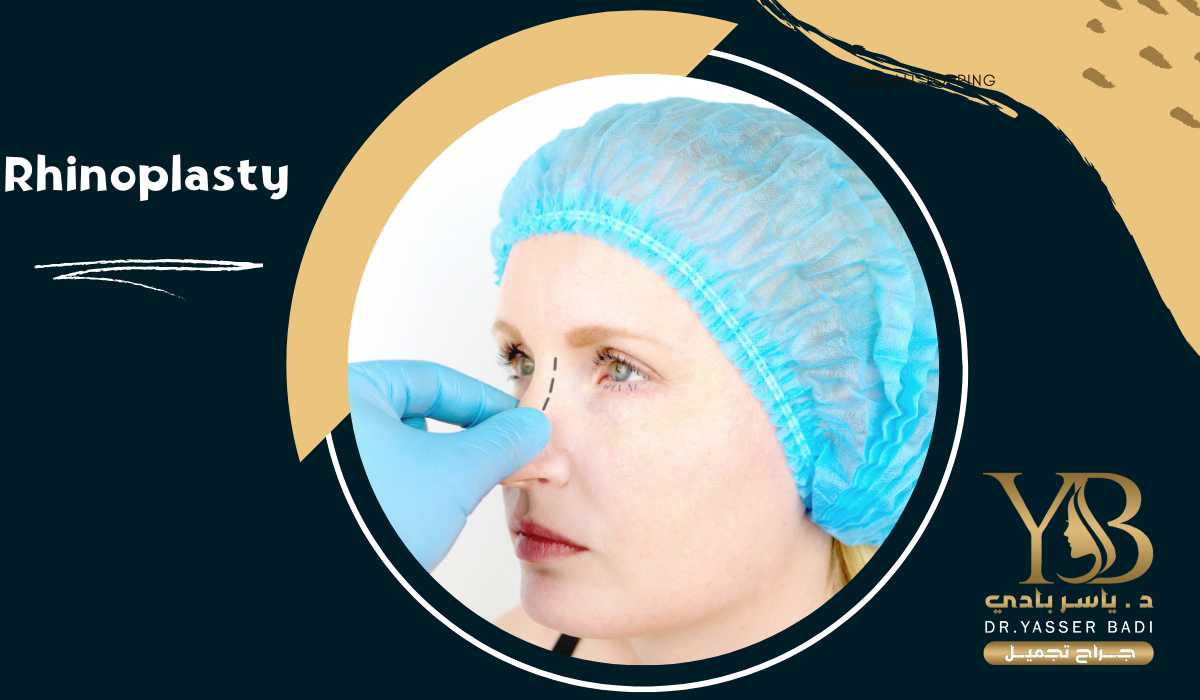 Rhinoplasty