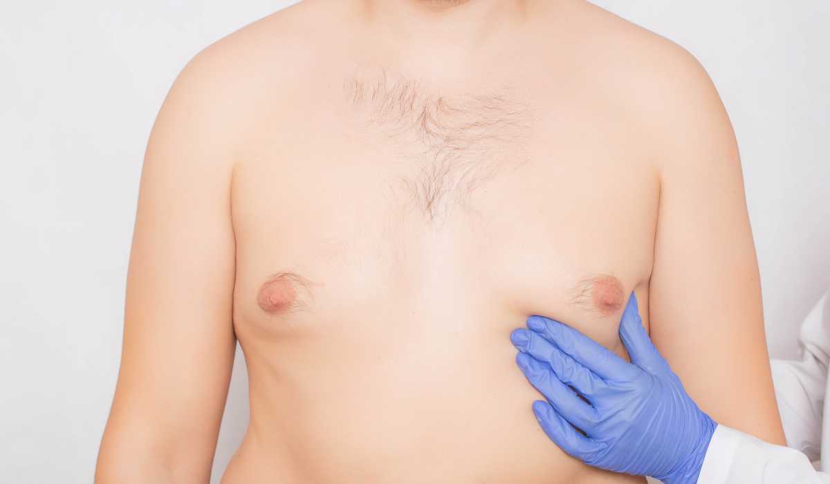gynecomastia surgery
