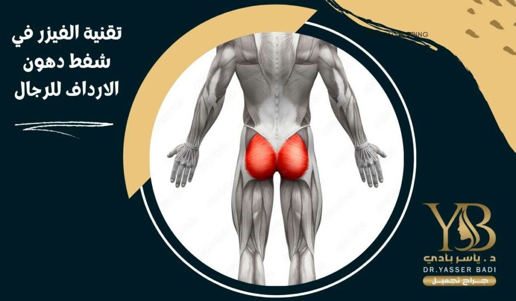 تقنية الفيزر في شفط دهون الارداف للرجال