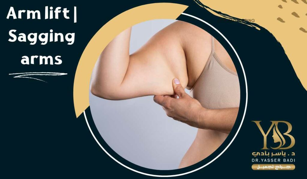 Arm lift Sagging arms
