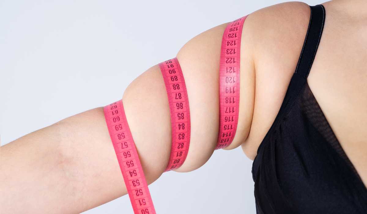 Arm lift Sagging arms