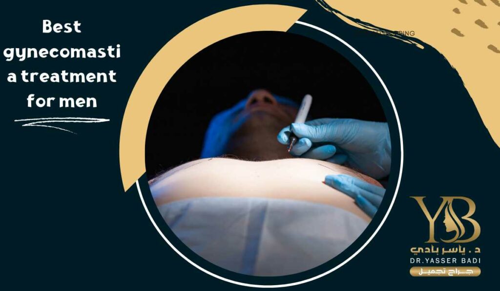 Best gynecomastia treatment for men