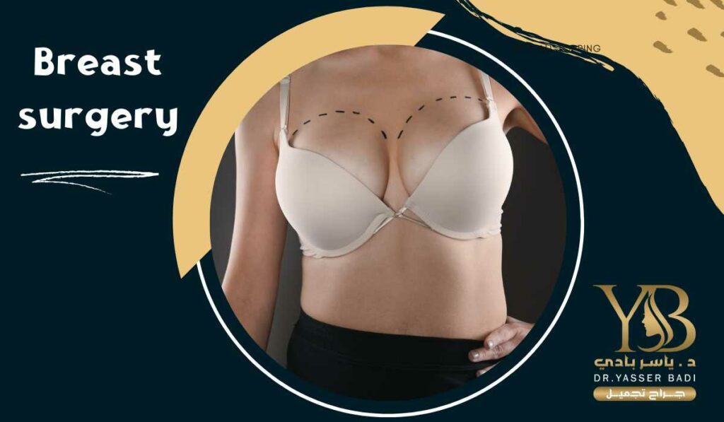 Breast surgery