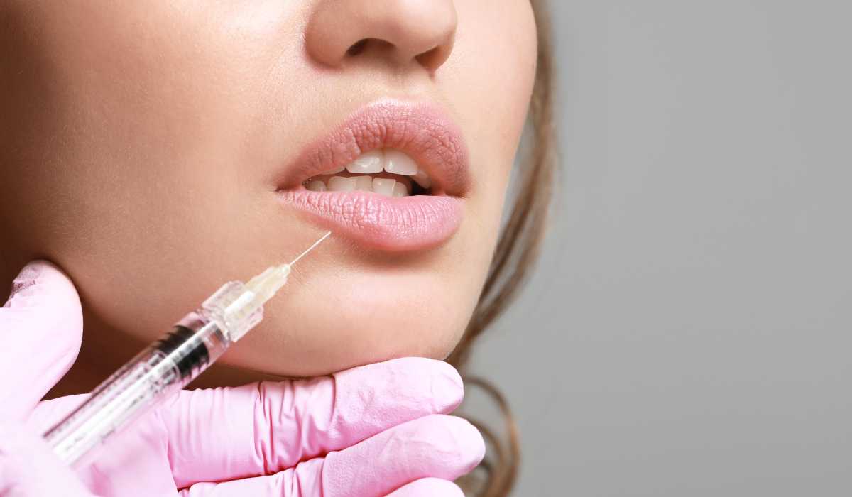 Lip lift