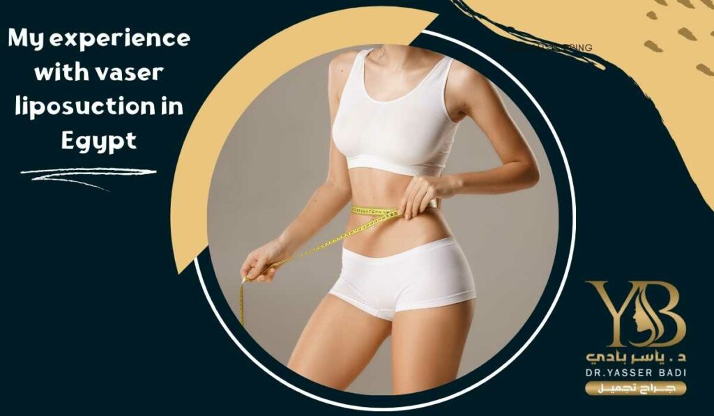 My experience with vaser liposuction in Egypt