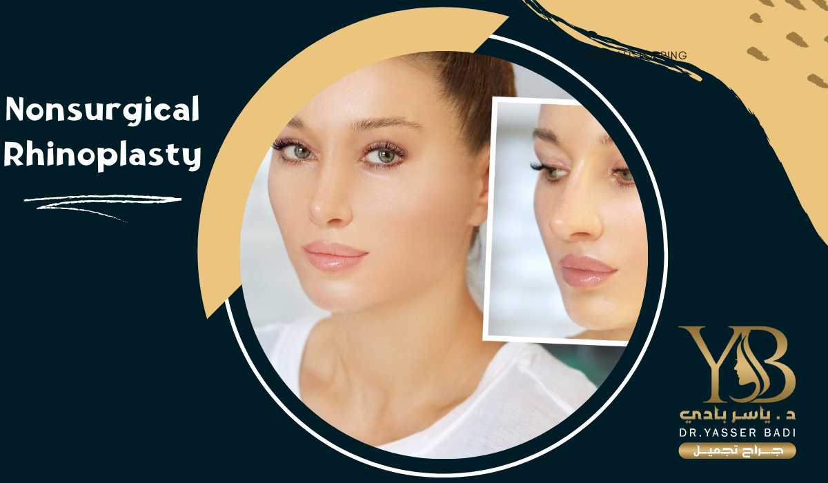 Nonsurgical Rhinoplasty