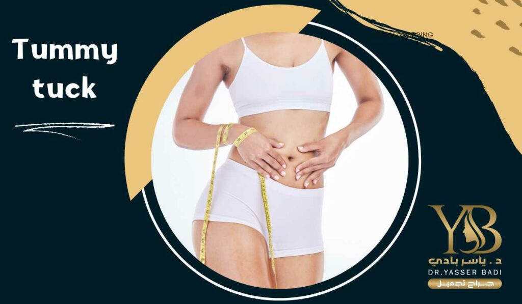 Tummy tuck
