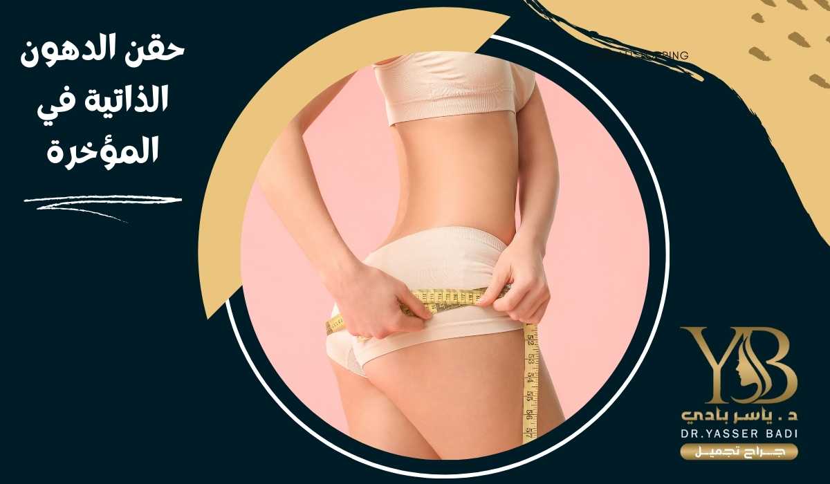 حقن الدهون الذاتية في المؤخرة