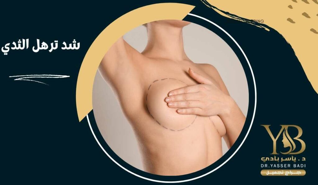 شد ترهل الثدي