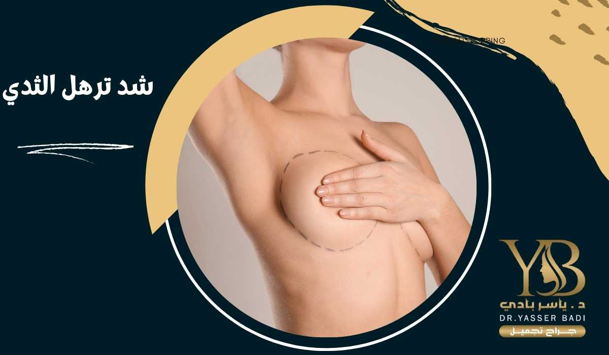 شد ترهل الثدي