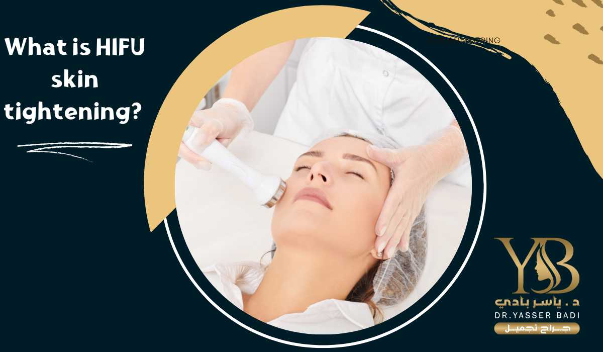 What is HIFU skin tightening?