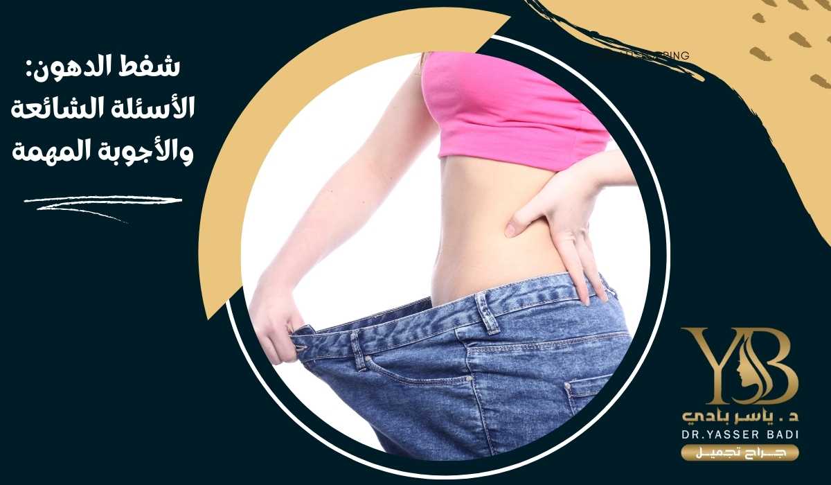 شفط الدهون: الأسئلة الشائعة والأجوبة المهمة