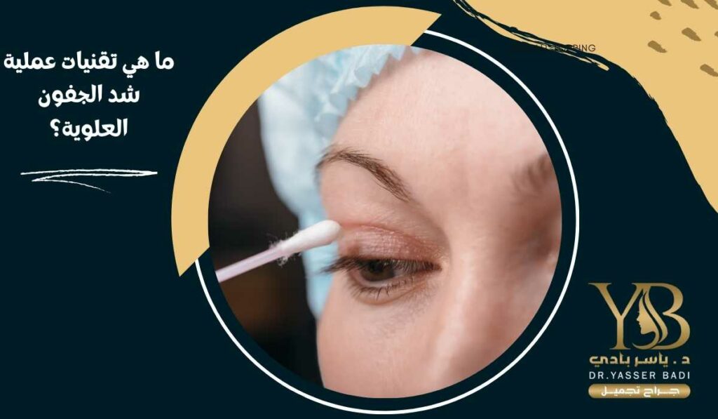 ما هي تقنيات عملية شد الجفون العلوية؟
