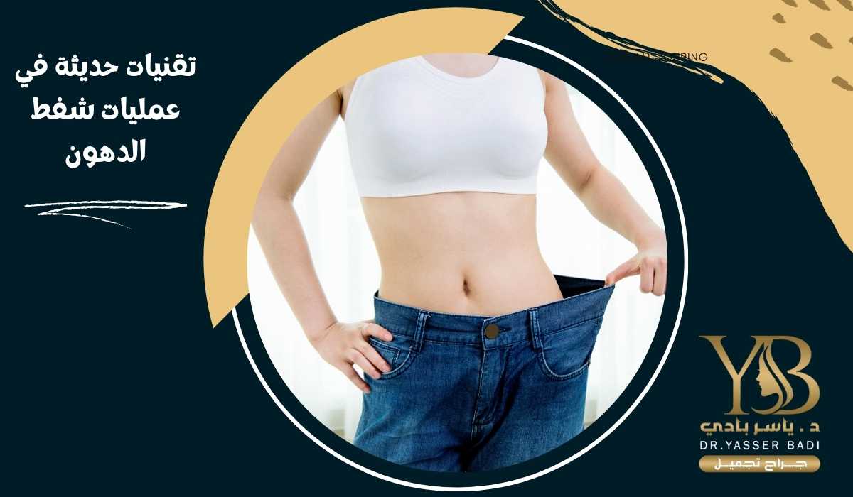 تقنيات حديثة في عمليات شفط الدهون