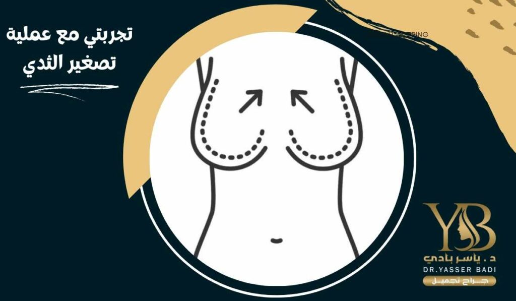 تجربتي مع عملية تصغير الثدي