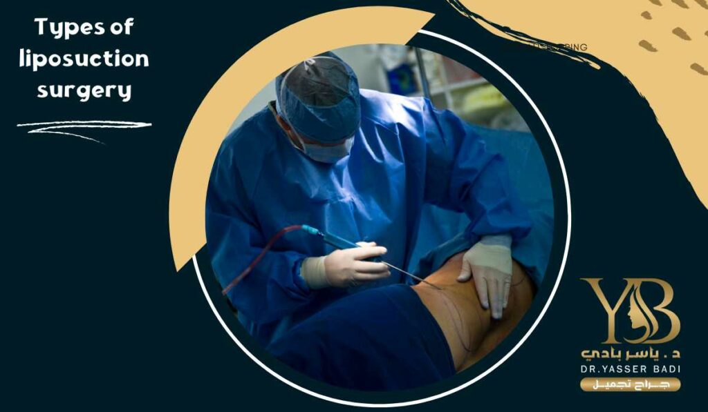 Types of liposuction surgery