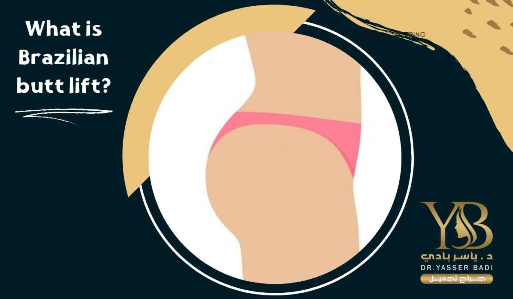 What is a Brazilian butt lift