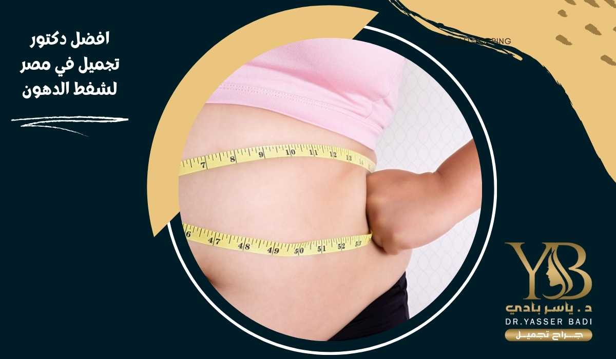 افضل دكتور تجميل في مصر لشفط الدهون