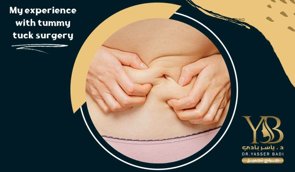 My experience with tummy tuck surgery