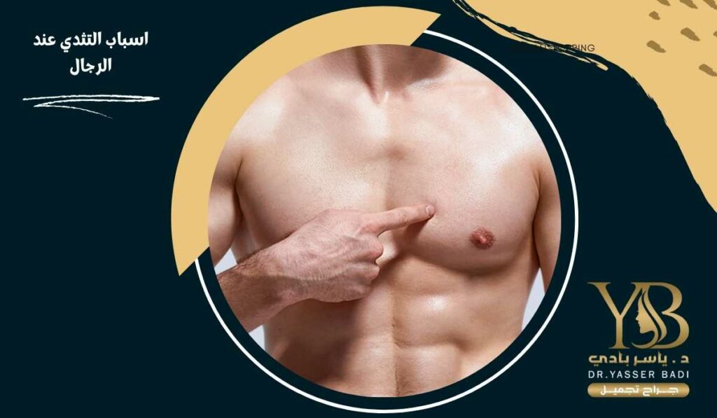 اسباب التثدي عند الرجال