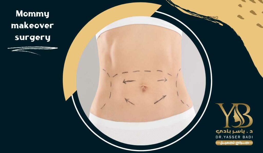 Mommy makeover surgery