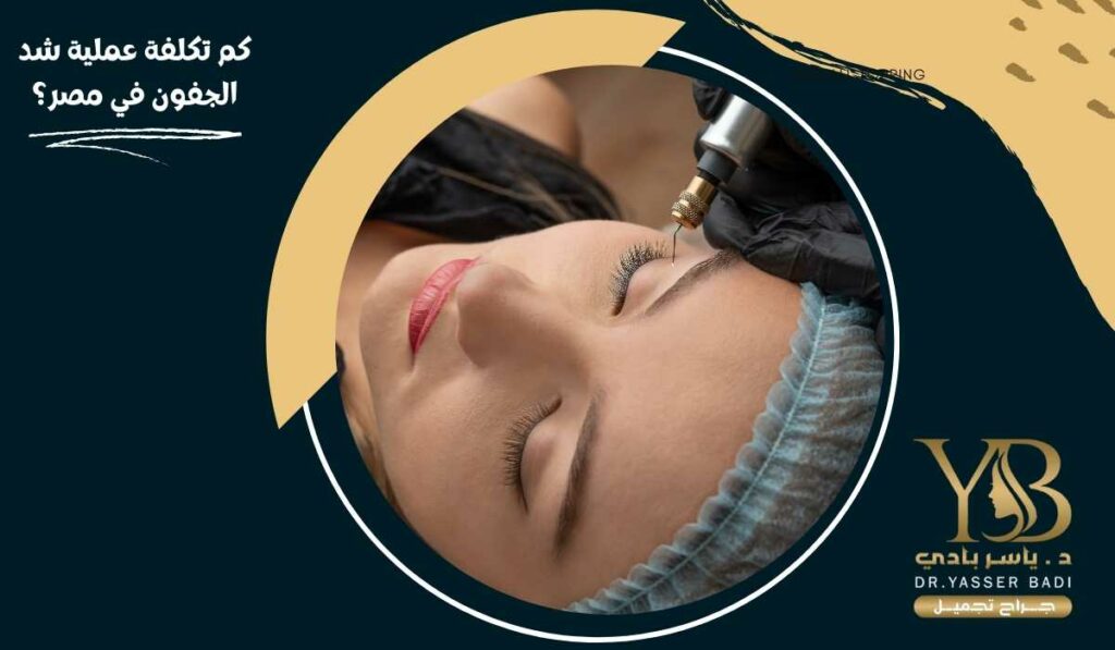 كم تكلفة عملية شد الجفون في مصر؟