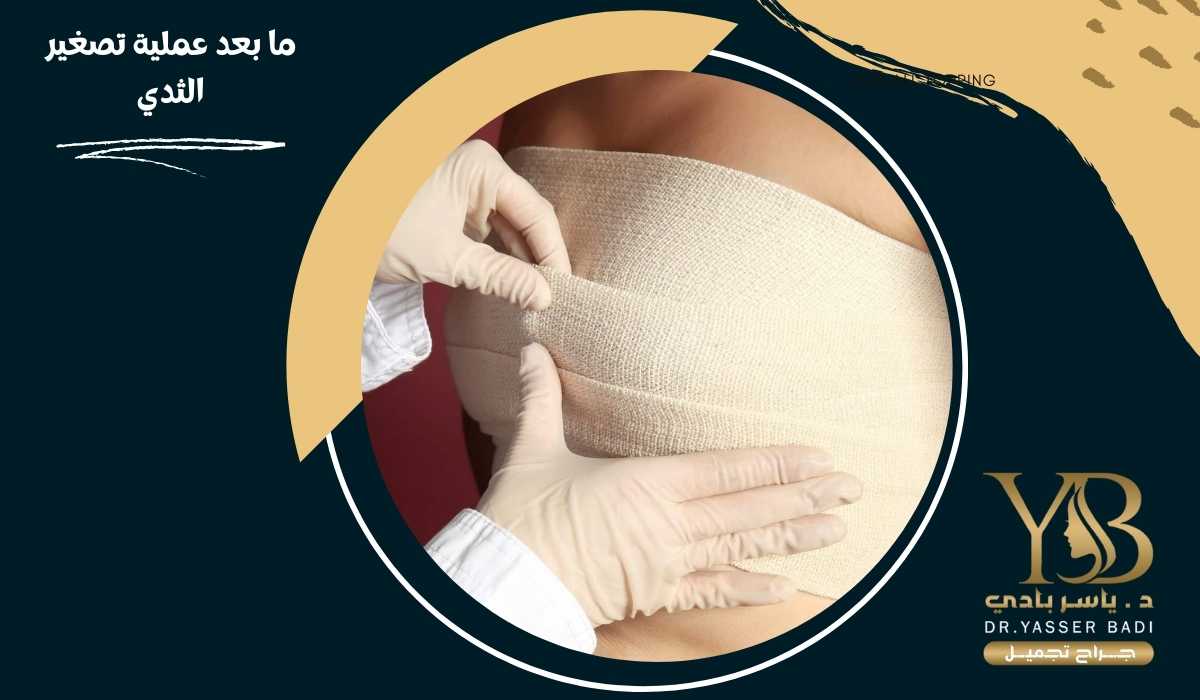ما بعد عملية تصغير الثدي