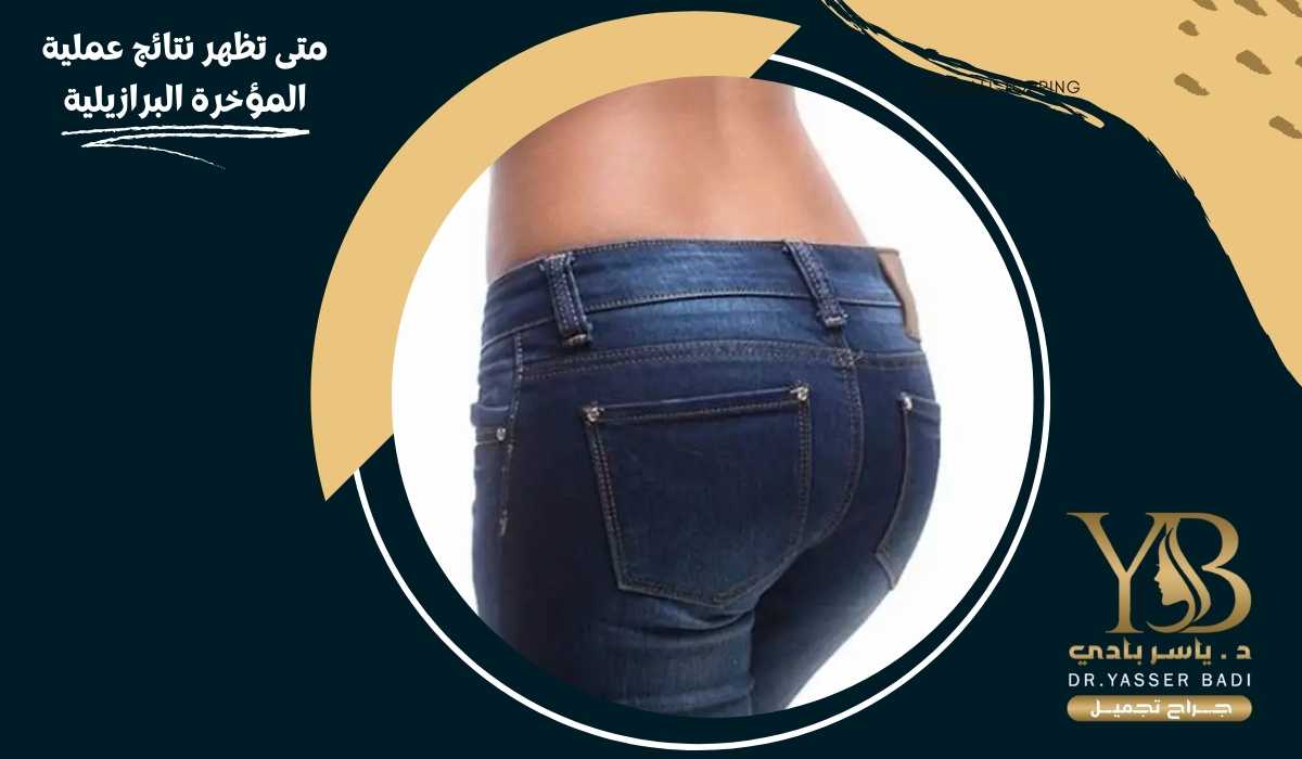متى تظهر نتائج عملية المؤخرة البرازيلية