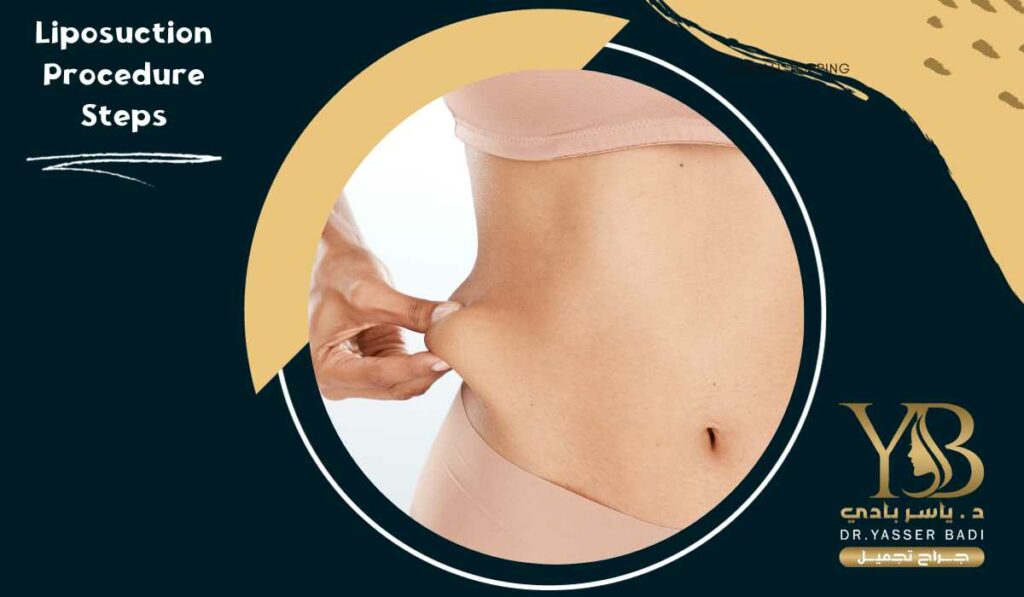 Liposuction Procedure Steps