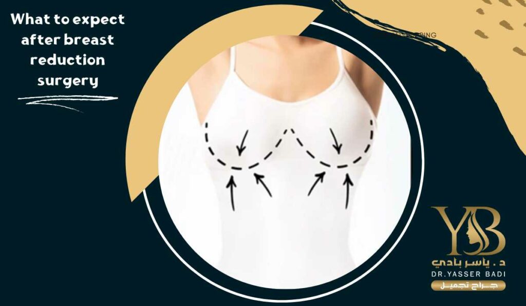 What to expect after breast reduction surgery