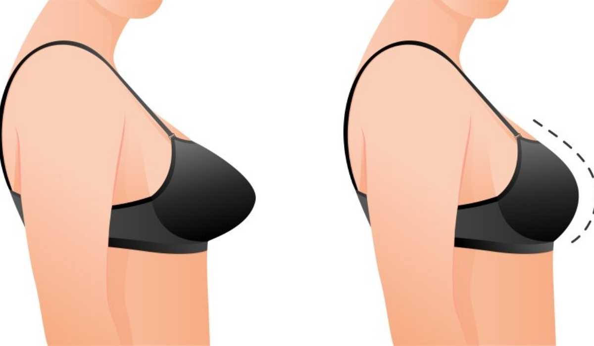 افضل جراح تجميل لعملية تصغير الثدي