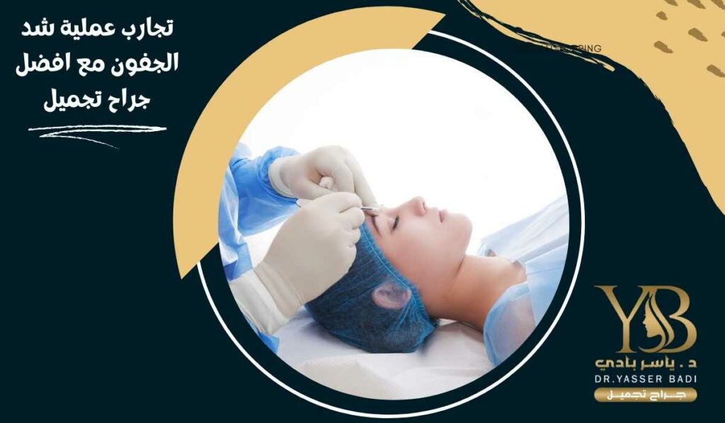 تجارب عملية شد الجفون مع افضل جراح تجميل