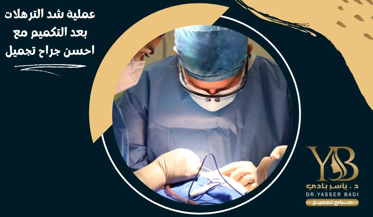 عملية شد الترهلات بعد التكميم مع احسن جراح تجميل
