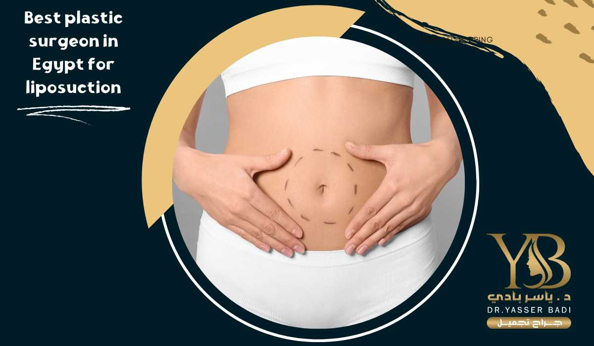 Best Plastic Surgeon For Liposuction