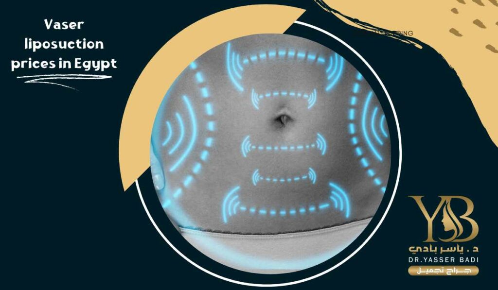 VASER liposuction prices in Egypt