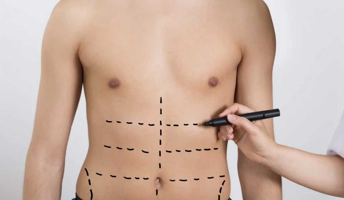 اشهر دكتور تجميل لشفط الدهون