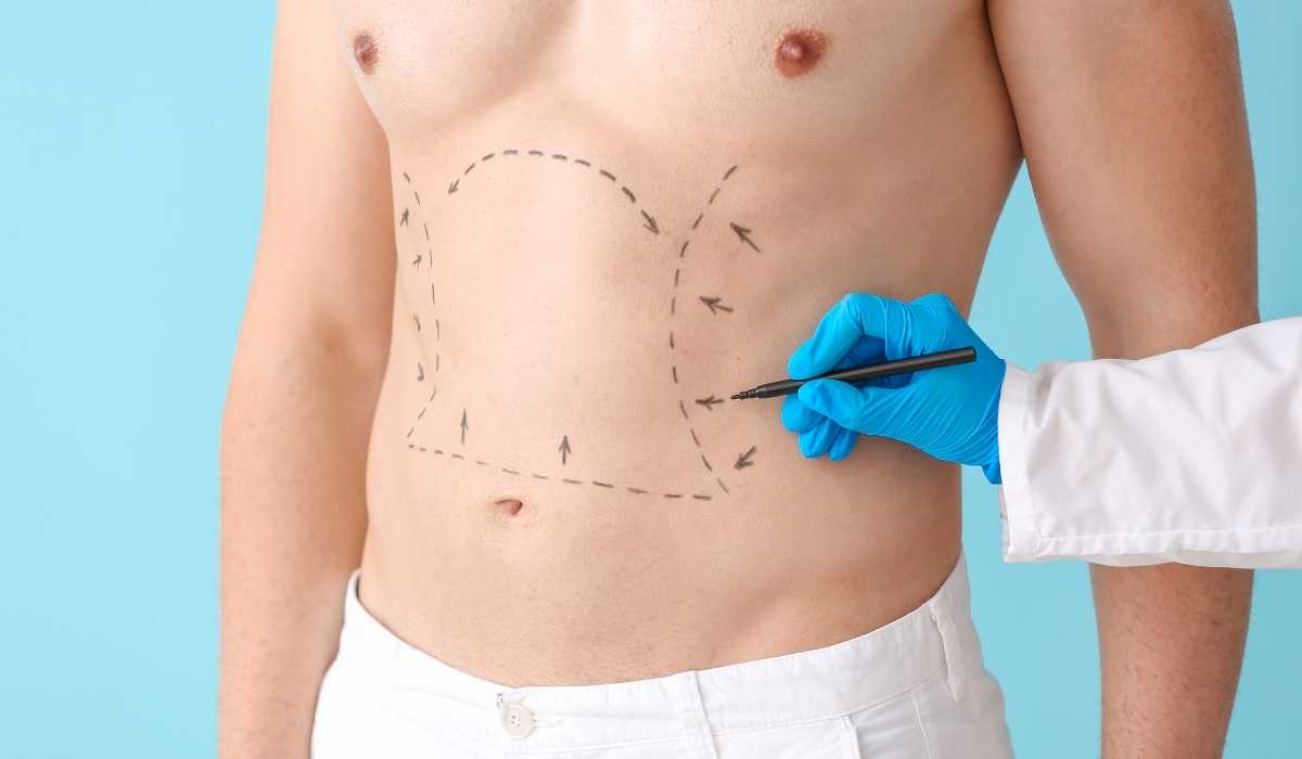 اشهر دكتور تجميل لعملية نحت الجسم